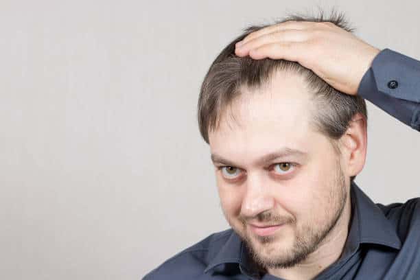 علاج تساقط الشعر في الشارقة